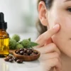 Does Castor Oil Clog Pores? The Real Answer